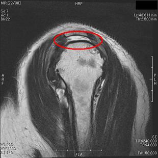 関節のMRI 職能別研修（放射線技師能力育成） | AR-Ex Medical Group